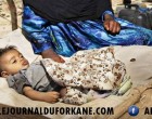 Combien d’enfants souffrent de malnutrition au Yémen ? Un nombre incroyable !