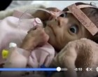 7 millions d’enfants au Yémen dorment le ventre au creux et souffrent de malnutrition à cause de la guerre et la pauvreté.
