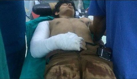 blesse de daesh en turquie 1