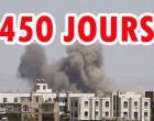450 jours que la coalition arabo-US continue de bombarder le Yemen