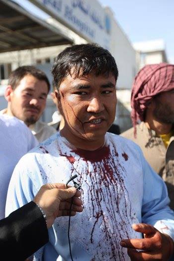 80 morts et 231 blessés dans un attentat suicide aujourd'hui à Kaboul 8