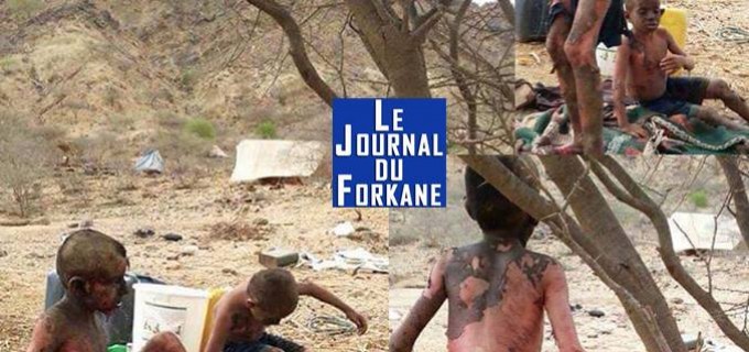 [IMAGE CHOC] Où est l’humanité?