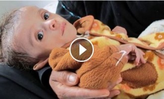 Près de 8 millions d’enfants au Yémen souffrent de la faim
