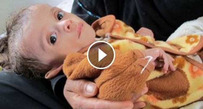 Près de 8 millions d’enfants au Yémen souffrent de la faim