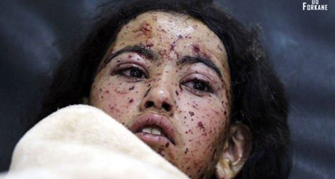 Une enfant yéménite sur un lit à l’hôpital après avoir été blessée dans les bombardements saoudiens !