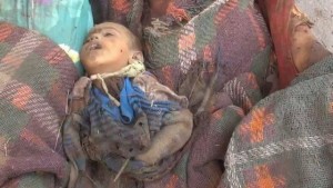 massacre à Al Hudaydah au Yémen commis par l’Arabie Saoudite3