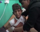 VIDEO: L’Aviation Saoudienne massacre les enfants du Yémen.. Et le monde reste encore silencieux !