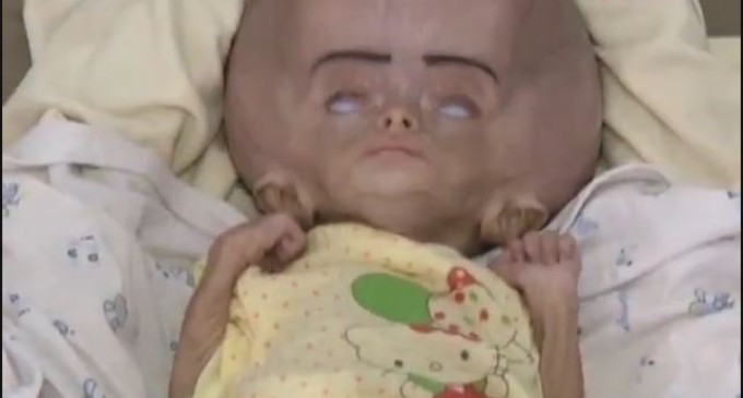 ATTENTION IMAGES CHOQUANTES !!! Des bébés yéménites avec des maladies rares causées par le régime saoudien qui bombarde sans cesse le Yémen avec des armes interdites !!!