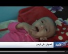 [Vidéo] | Des centaines de milliers d’enfants au Yémen confrontés à la mort