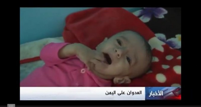 [Vidéo] | Des centaines de milliers d’enfants au Yémen confrontés à la mort