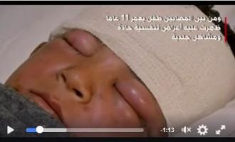 En vidéo.. La première attaque chimique de Daesh à l’est de Mossoul