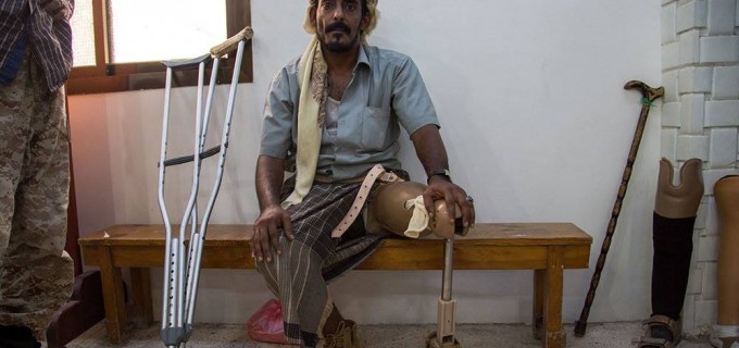 En photo : les effets des crimes de l’agression saoudienne contre le peuple yéménite