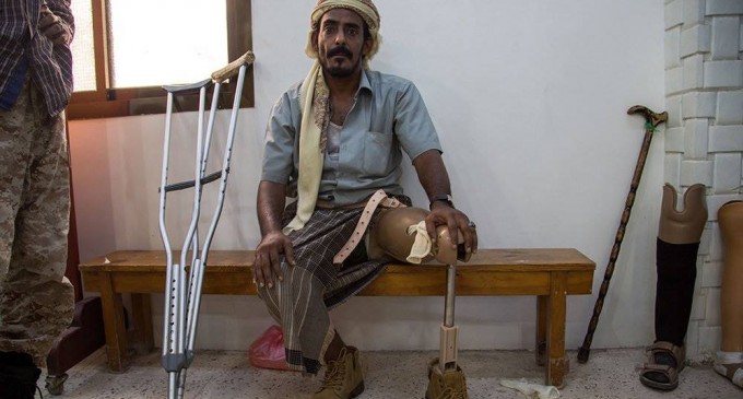 En photo : les effets des crimes de l’agression saoudienne contre le peuple yéménite