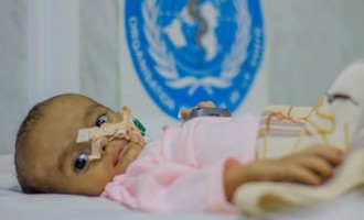 462 000 enfants yéménites âgés de moins de 5 ans souffrent de malnutrition aiguë