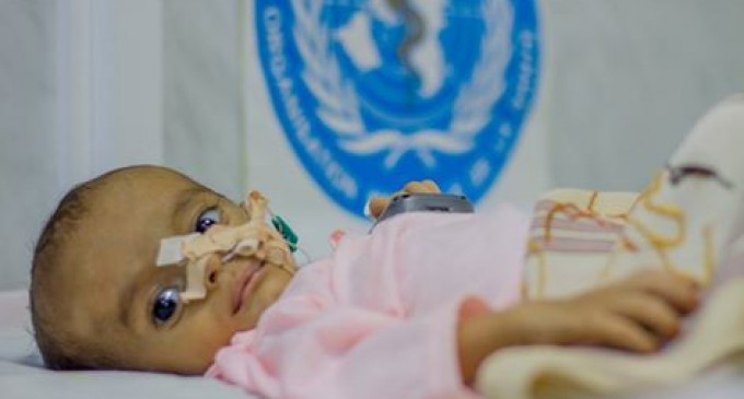 462 000 enfants yéménites âgés de moins de 5 ans souffrent de malnutrition aiguë