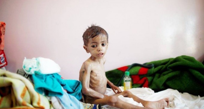 Les enfants yéménites meurent de faim en raison de l’absence de nourriture et de médicaments à cause du blocus saoudien
