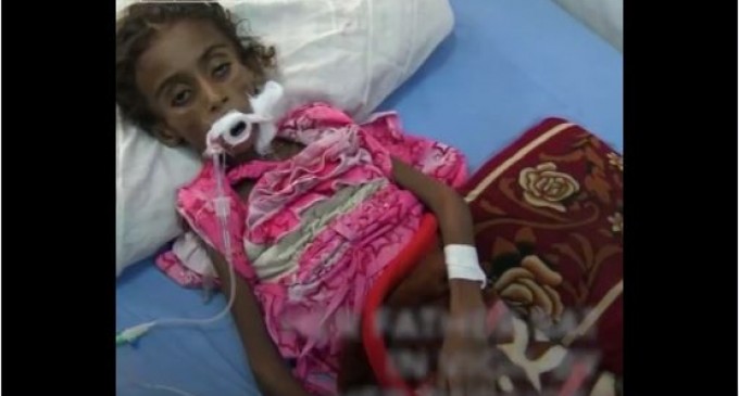 [Vidéo] | Un enfant meurt de faim toutes les 10 minutes au Yémen