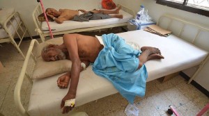 Le Yémen est en proie à une grave crise humanitaire3