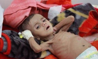 Le choléra se propage comme une traînée de poudre à travers le Yémen ravagé par la guerre