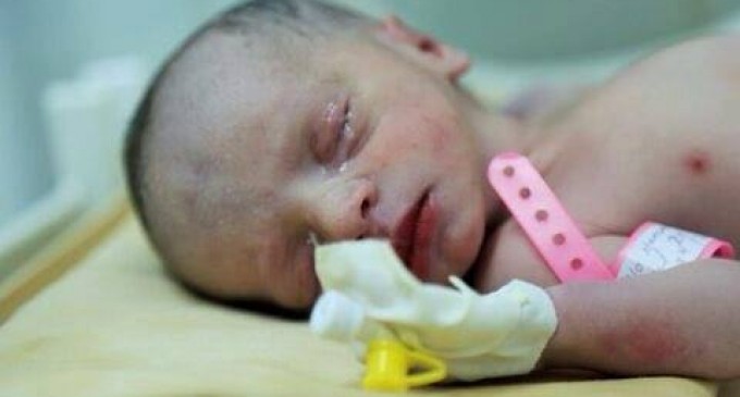 2 millions d’enfants souffrent de malnutrition dite « aiguë sévère » au Yémen