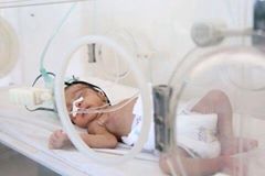 2 millions d'enfants souffrent de malnutrition dite « aiguë sévère » au Yémen2