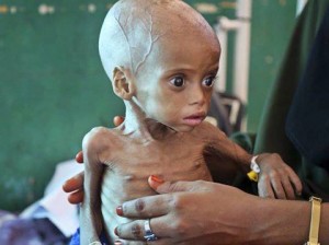 Le Yémen a longtemps lutté contre la malnutrition. Mais l'embargo de la coalition saoudienne a détruit les systèmes de distribution et a fait entrer le pays dans la famine.1