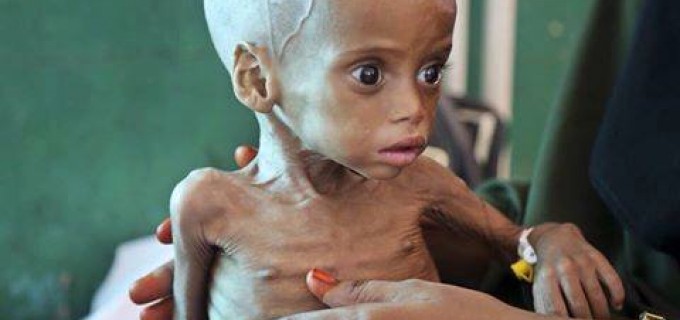 Le Yémen a longtemps lutté contre la malnutrition. Mais l’embargo de la coalition saoudienne a détruit les systèmes de distribution et a fait entrer le pays dans la famine.