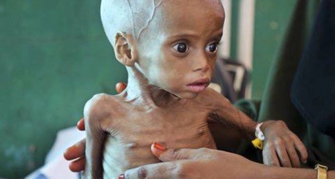 Le Yémen a longtemps lutté contre la malnutrition. Mais l’embargo de la coalition saoudienne a détruit les systèmes de distribution et a fait entrer le pays dans la famine.
