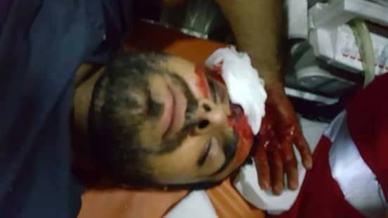 Regardez comment les forces d'occupations israéliennes battent les fidèles Palestiniens à al-Aqsa3