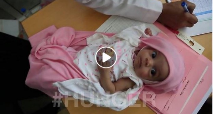 [Vidéo] | Plus de 2 années de conflit au Yémen ont provoqué une famine