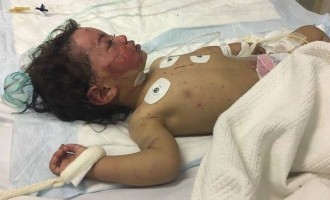 1 enfant meurt toutes les 10 minutes au Yémen