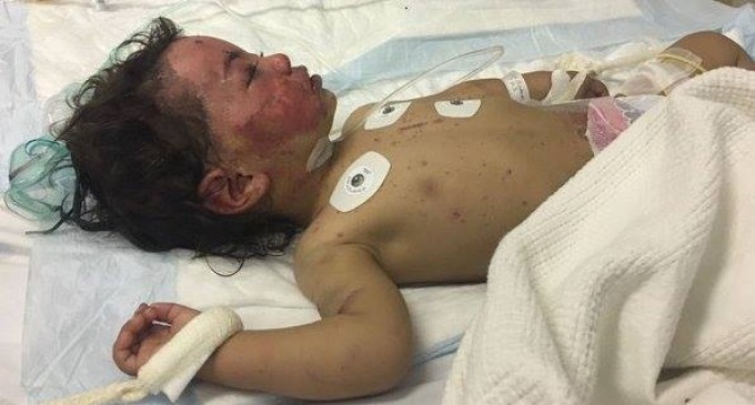 1 enfant meurt toutes les 10 minutes au Yémen