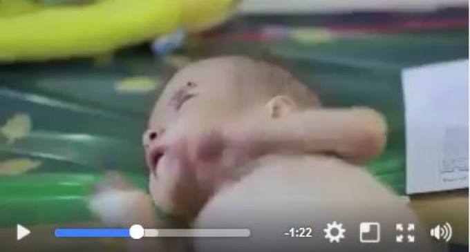 Faim, malnutrition et choléra sont les conséquences dévastatrices pour les enfants du Yémen en raison du blocus imposé par les USA, l’Arabie Saoudite et les pays du golfe !!!