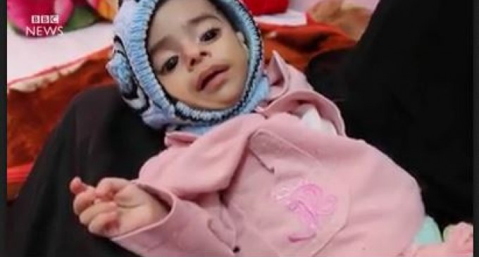 [VIDEO] Les enfants au Yémen affaiblis par la faim à cause du siège saoudien