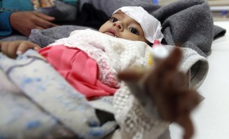 Yémen : Près de 2000 personnes mortes du choléra sur les14 dernières semaines
