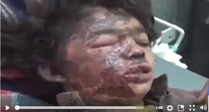 ATTENTION IMAGES CHOQUANTES: La coalition arabo-US tueuse d’enfants au Yémen
