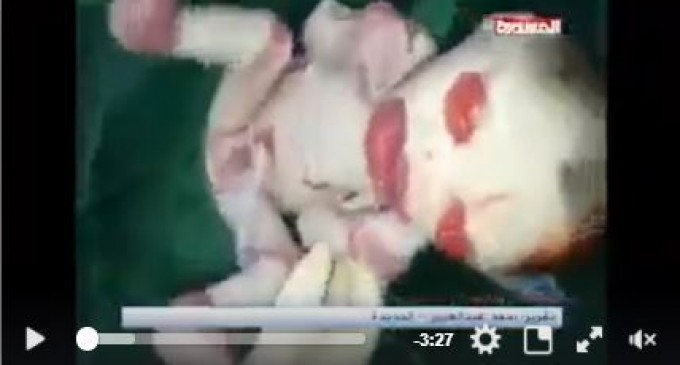 Quel genre d&rsquo;armes interdites sont utilisées au Yémen par la coalition Arabo-US ?