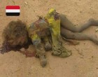 Les crimes des Saoud au Yémen.