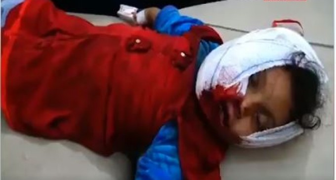 [Vidéo] | Une jeune yéménite de 3 ans blessée par une attaque à la roquette sur son école dans le district de Razih (Gouvernorat de Saada)