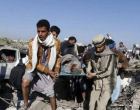 NOUVEAU MASSACRE AU YÉMEN !!! 6 civils tués et blessées par la coalition Arabo-US