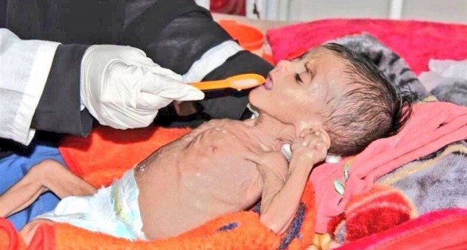 991 jours d’agression et de siège sur le Yémen