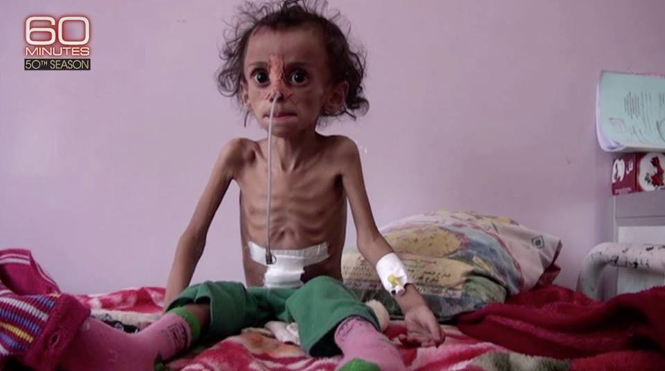 991 jours d'agression et de siège sur le Yémen2