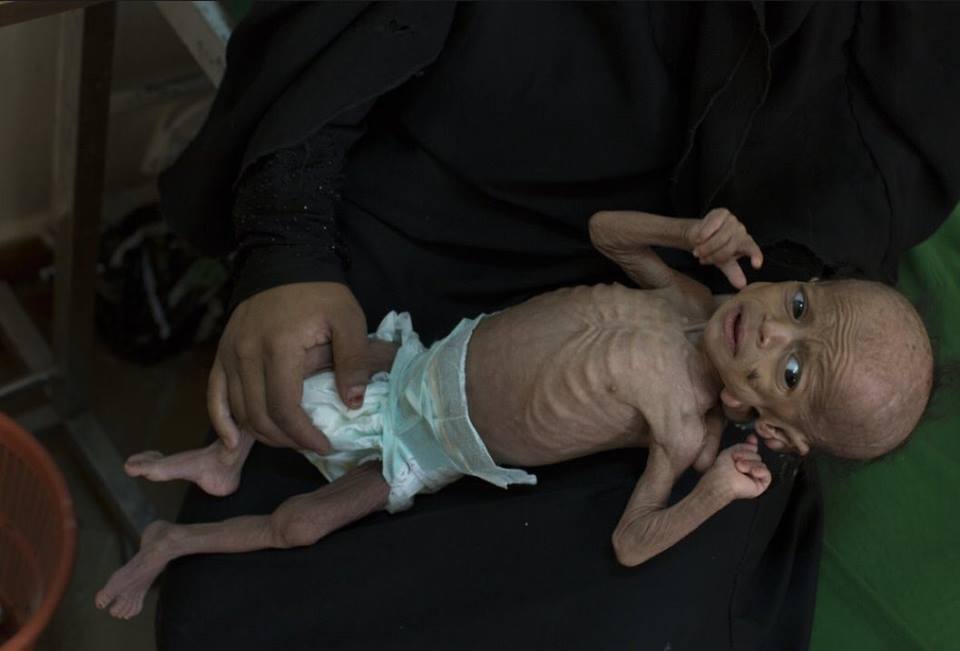 991 jours d'agression et de siège sur le Yémen3