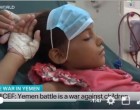 « Une guerre contre les enfants » C’est ainsi que l’Unicef décrit la guerre saoudienne sur le Yémen
