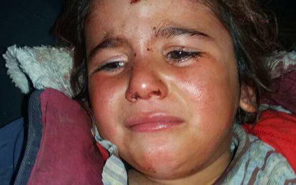 35 civils tués depuis le début des attaques turques, le 20 janvier contre les Kurdes d'Afrin4