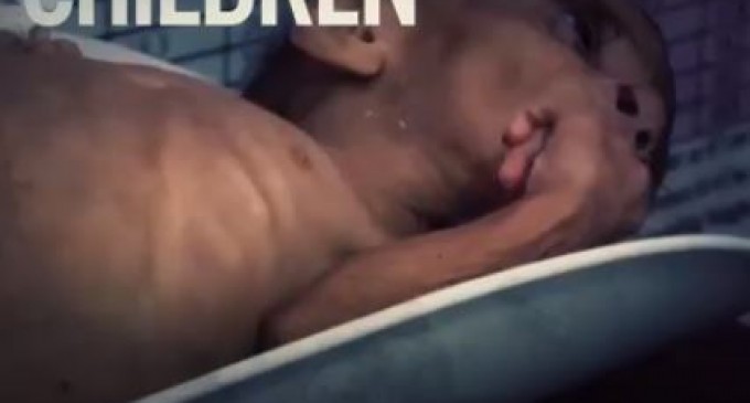 Famine au Yémen : à l’intérieur du seul hôpital du pays traitant de la malnutrition (avertissement : images choquantes)