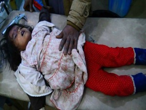 La coalition Arabo-US commet un nouveau massacre horrible dans le district de Sahar2