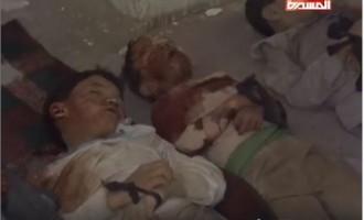 Voici l&rsquo;histoire des enfants oubliés du Yémen…