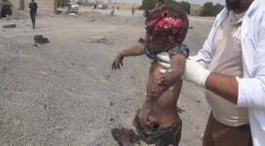 14 civils pour la plupart des femmes et des enfants tués lors d’un raid aérien de la coalition arabo-US2