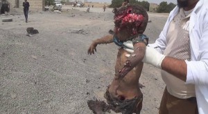 14 civils pour la plupart des femmes et des enfants tués lors d’un raid aérien de la coalition arabo-US2